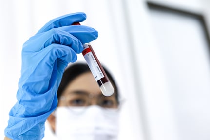 Scientist holding up tube filled with a blood sample