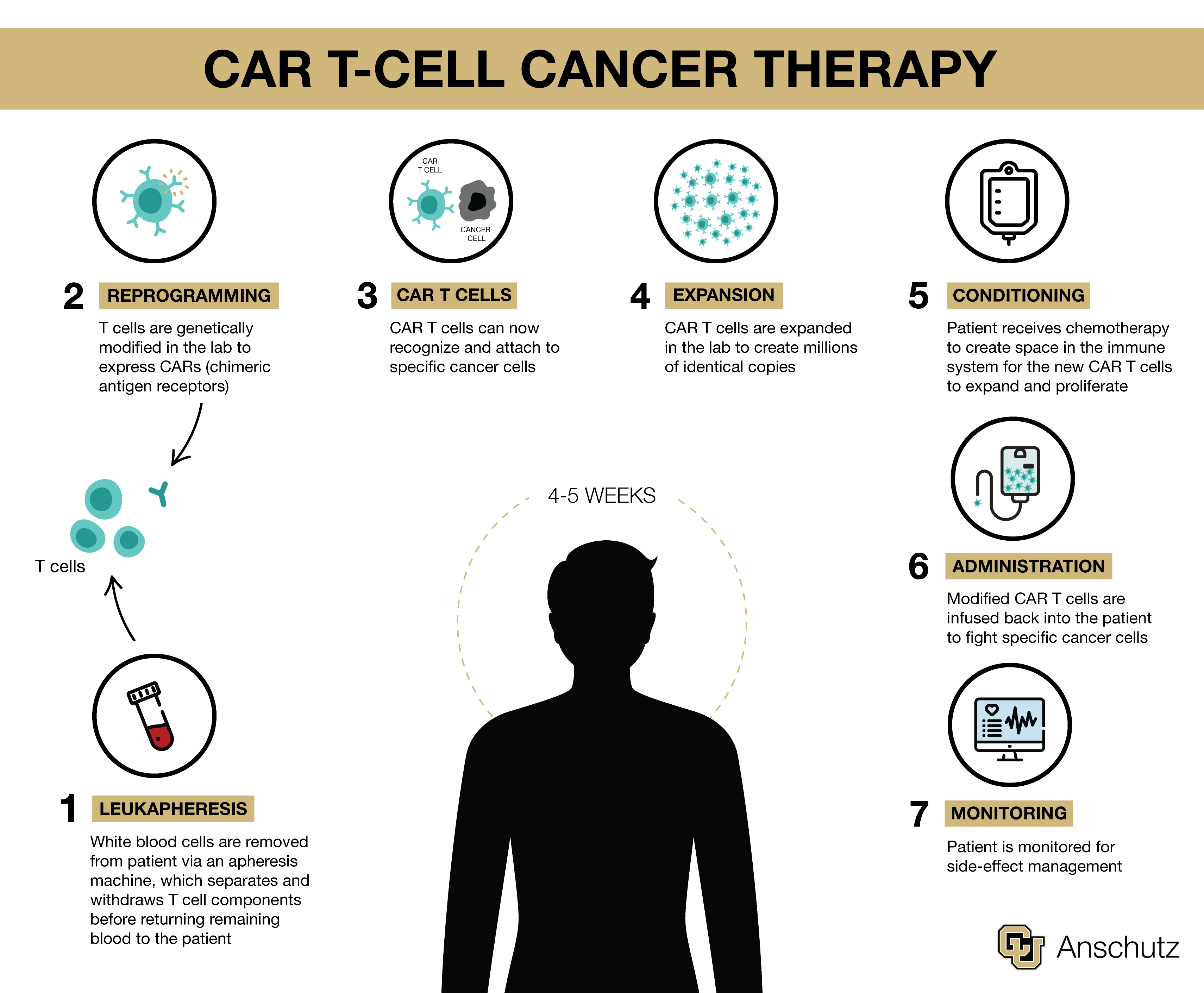 car-t-cell-therapy-graphic