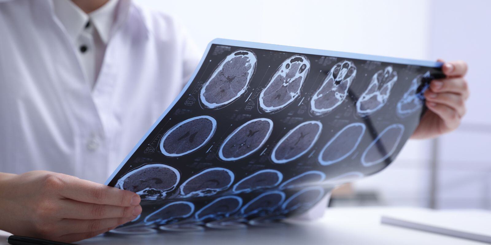 Doctor examines MRI of a patient's brain