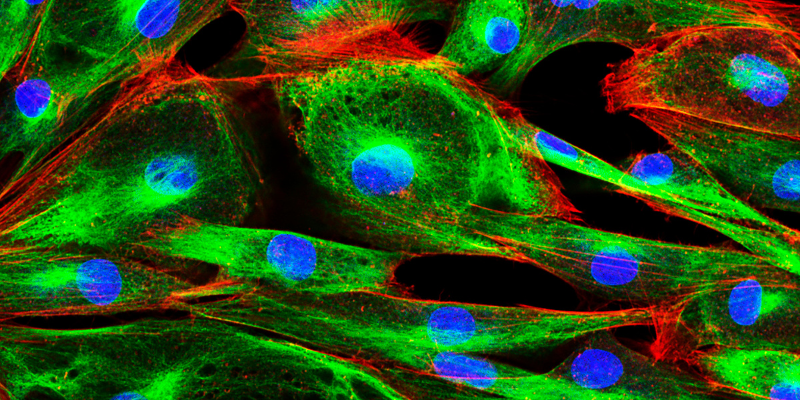 Fluorescence microscopy with green, blue and red colors