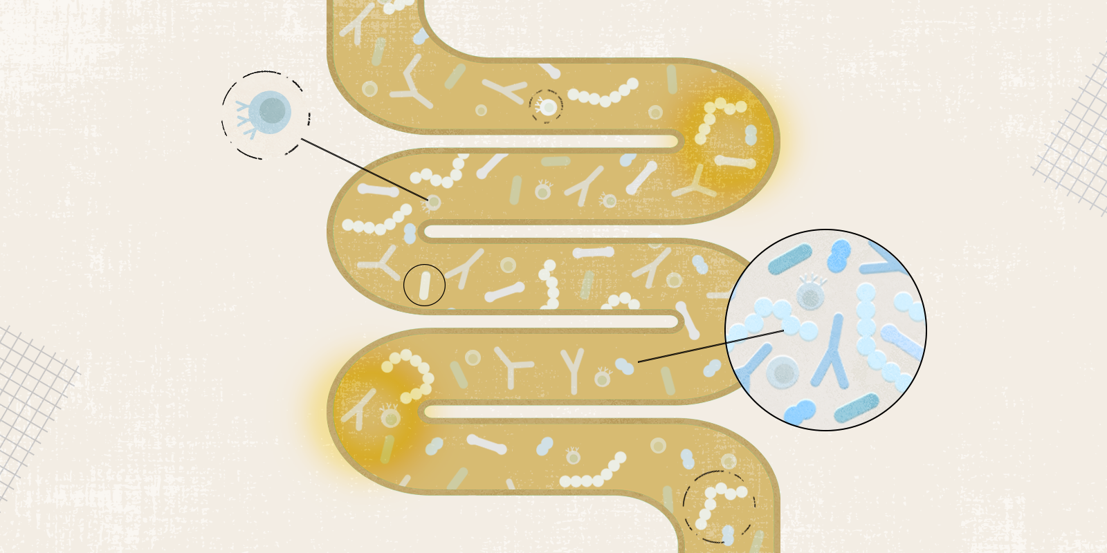 Graphic representation of the human colon with microbes spread throughout.