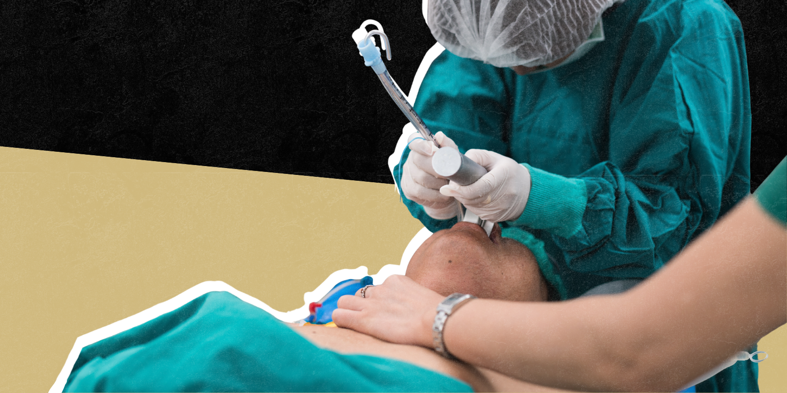 Photo of a patient being intubated in an emergency room 