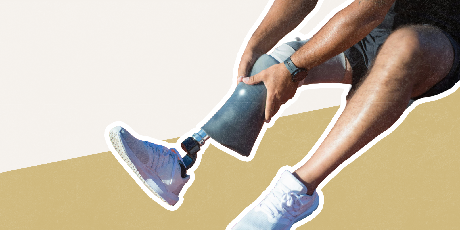 Photo of a person with a bone anchored limb