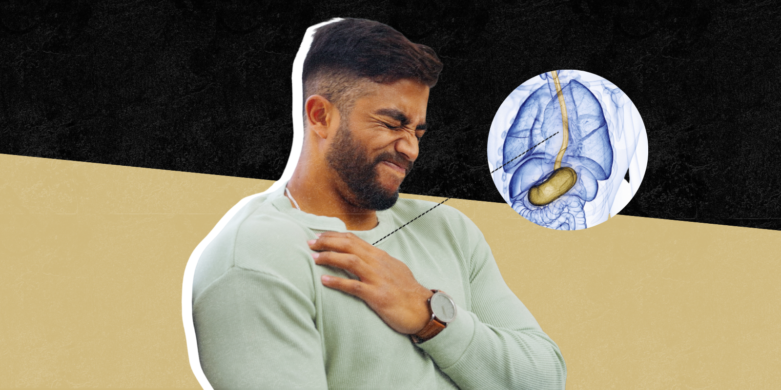 A young man grabs his chest and grimaces in pain; a graphic of an esophagus points to his chest