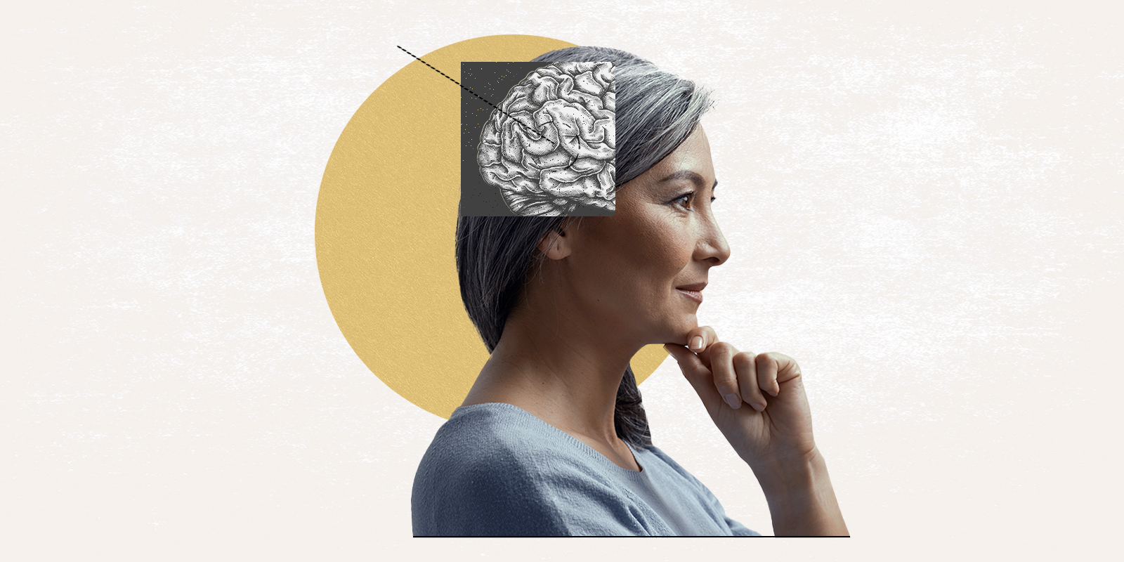 woman with gray hair considers deep brain stimulation for Parkinson's disease.