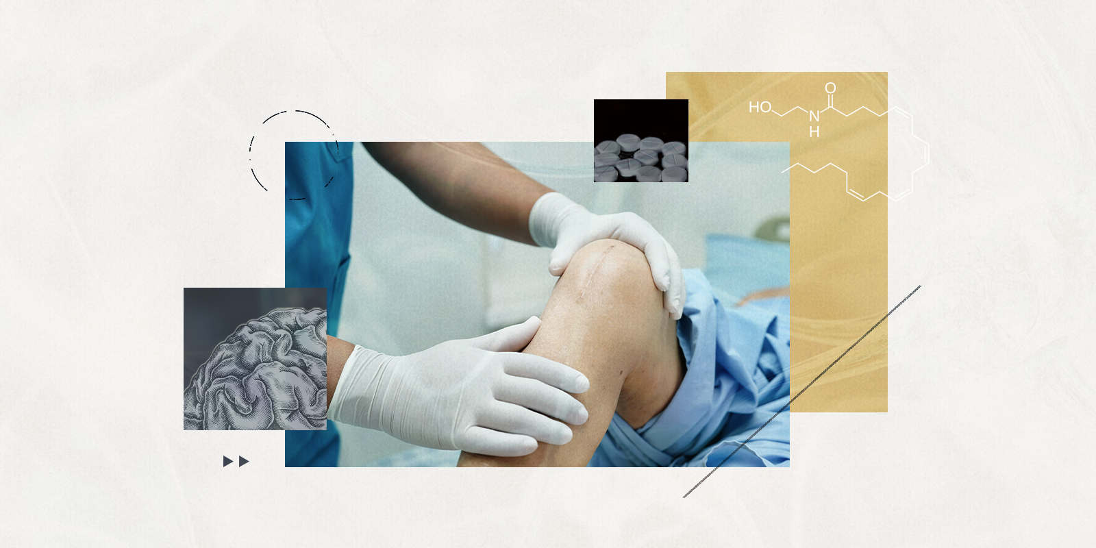 A medical provider wearing white gloves holds a knee with a scar before surgery