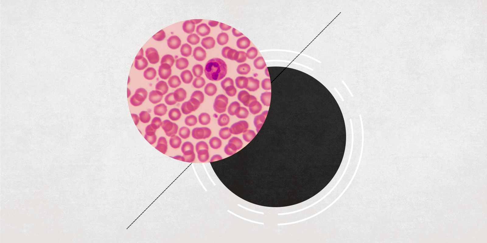 A stylized image showing a microscopic view blood cells in a circle, with a shadow circle behind it. 