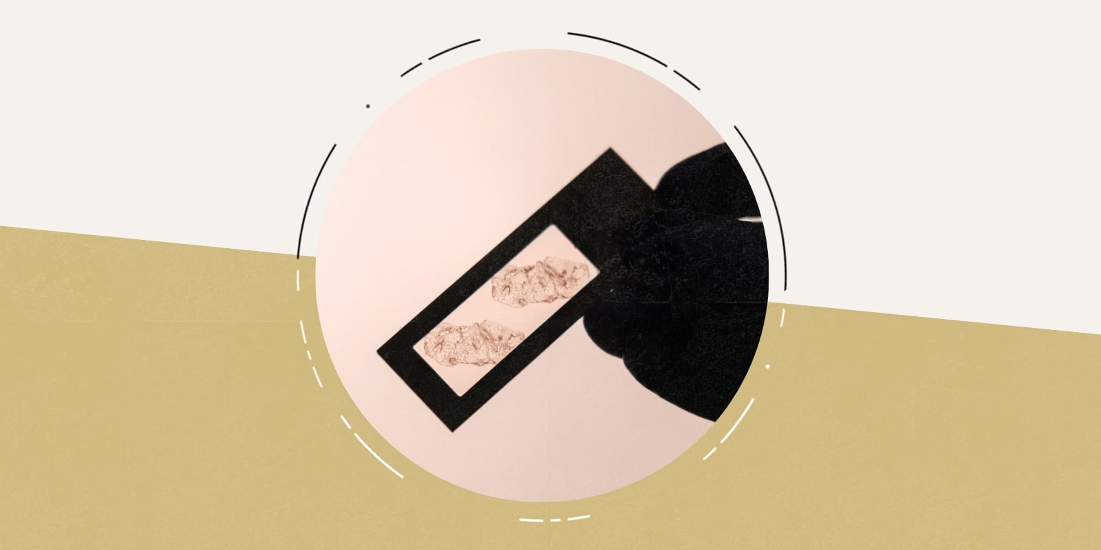 Hand holding microscope slide with shingles virus