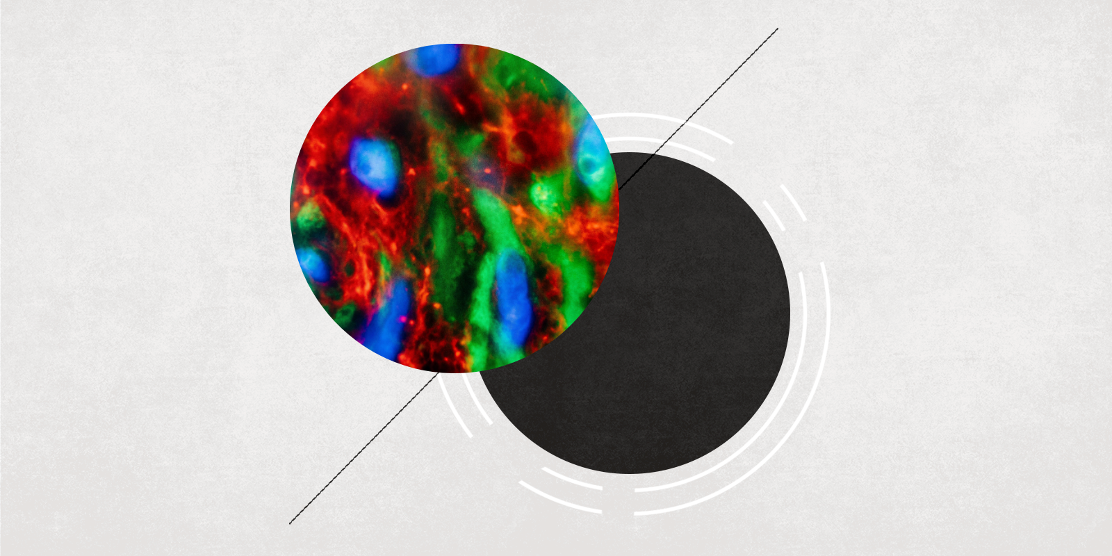 Stylized banner image for the CU Anschutz Explains series, showing what an organoid looks like under the microscope.