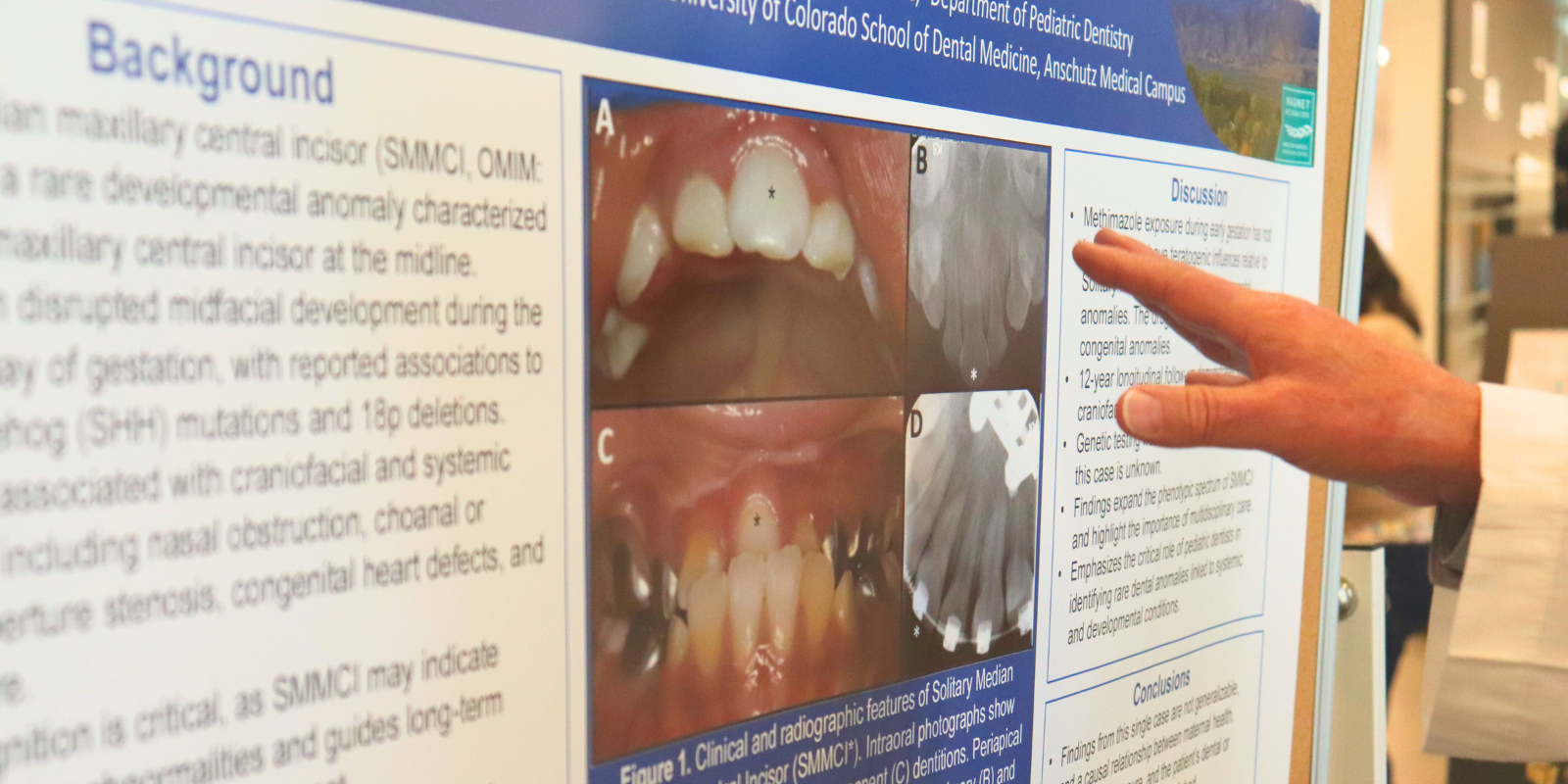 dental research poster with hand pointing