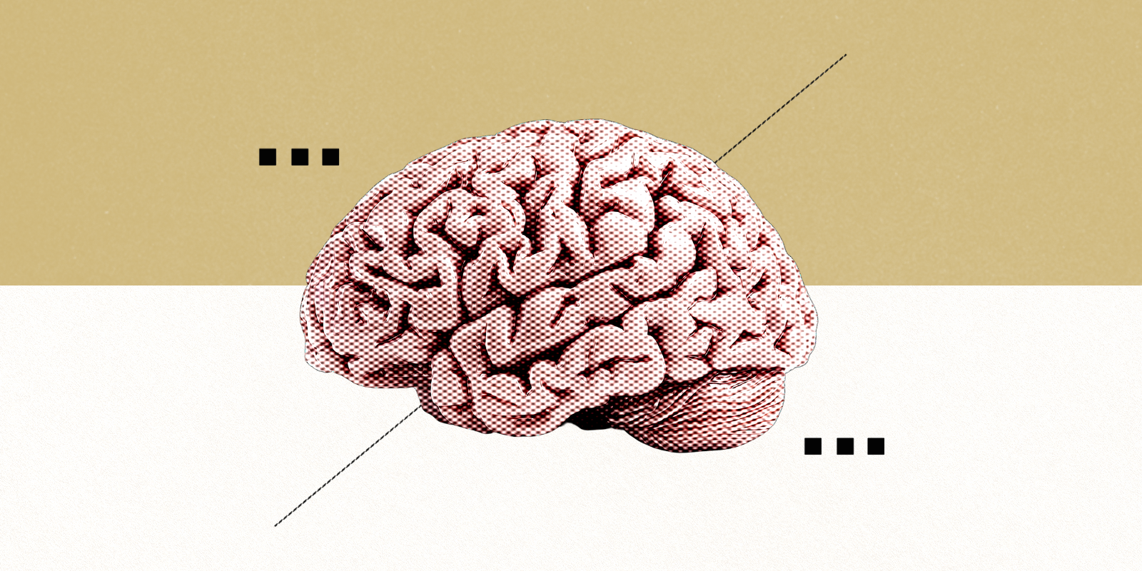 Image of brain with computerized pixels