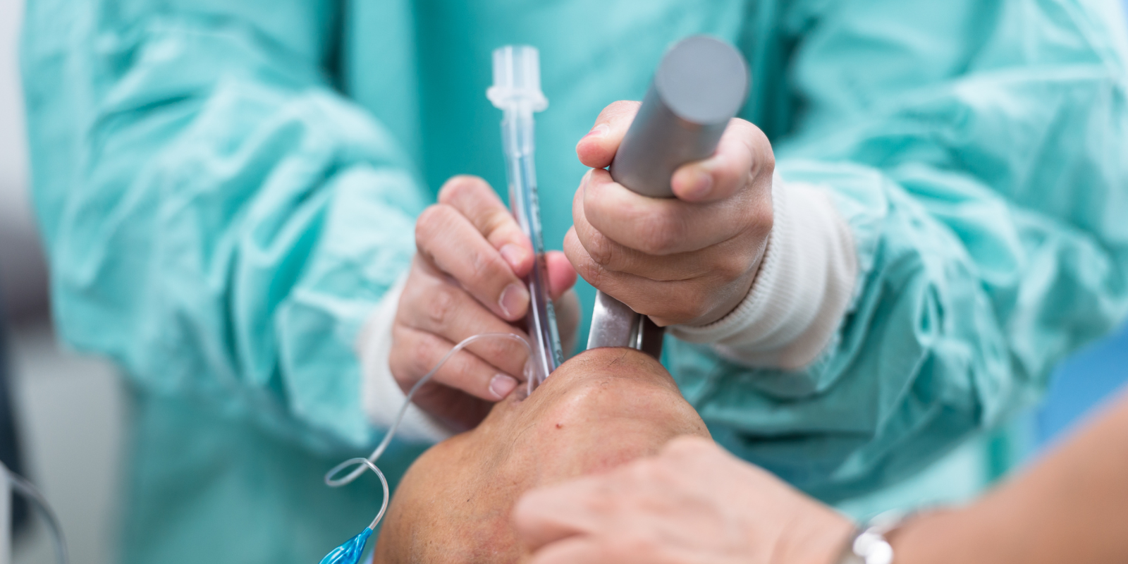 A patient undergoing endotracheal intubation 