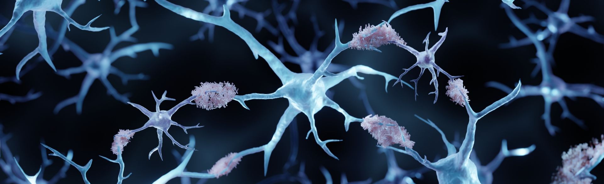 microscopic image of dendrites and amyloid plaques