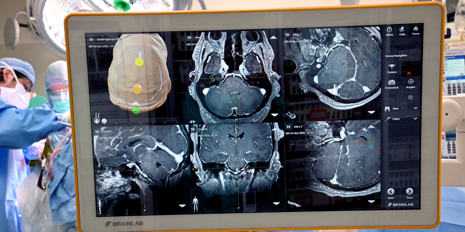 A series of images of the brain are on a display, from a variety of angles. In the lefthand corner past the display, surgery in the operating room is underway.