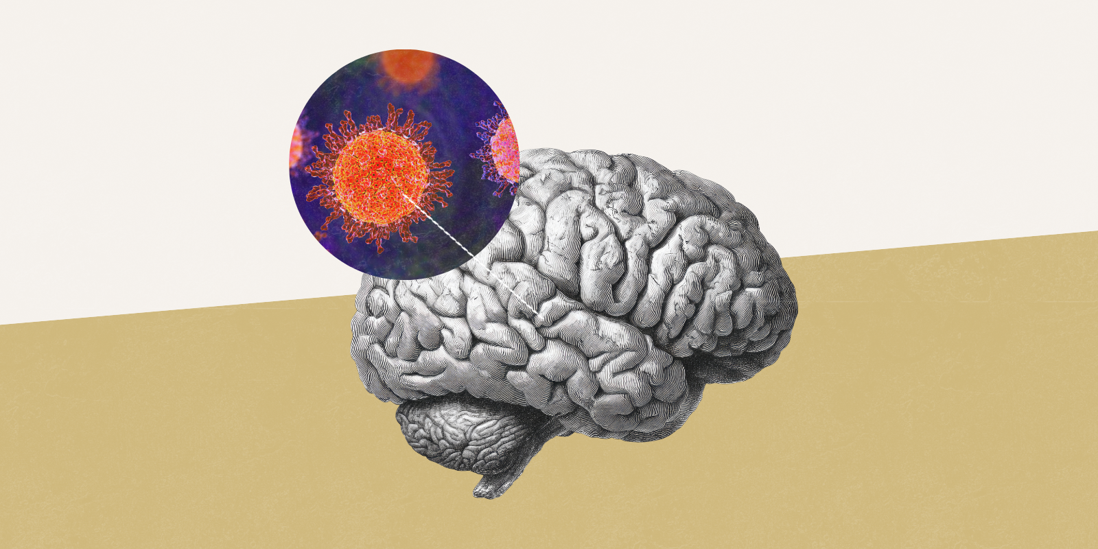 Graphic of a brain with a circle above it of microscopic viruses.