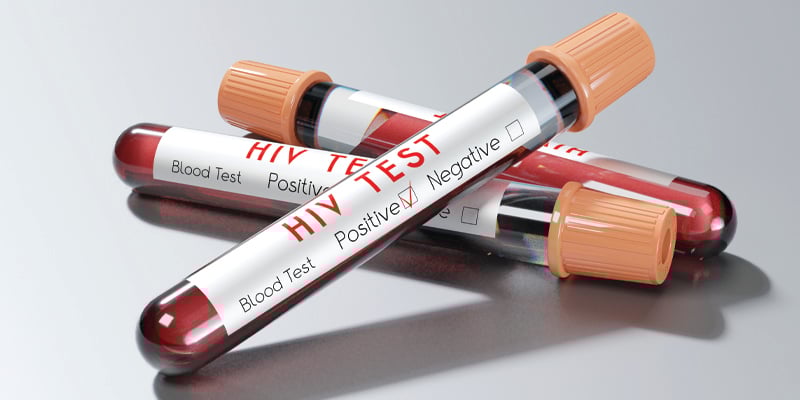 three hiv tests
