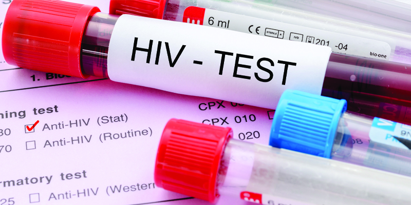 hiv test