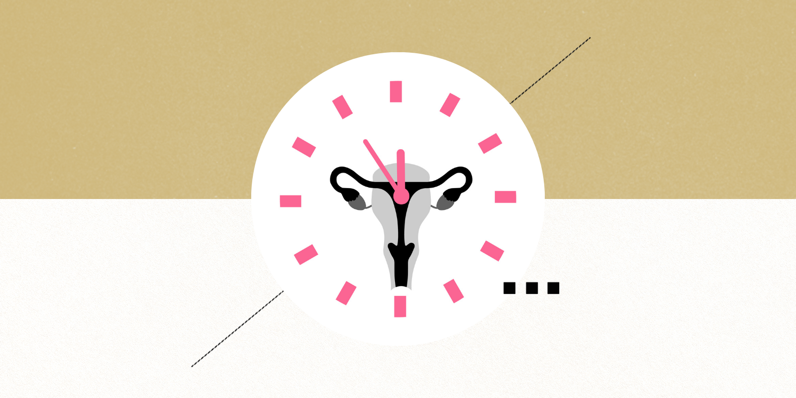 An illustration showing a uterus superimposed over a clock face.