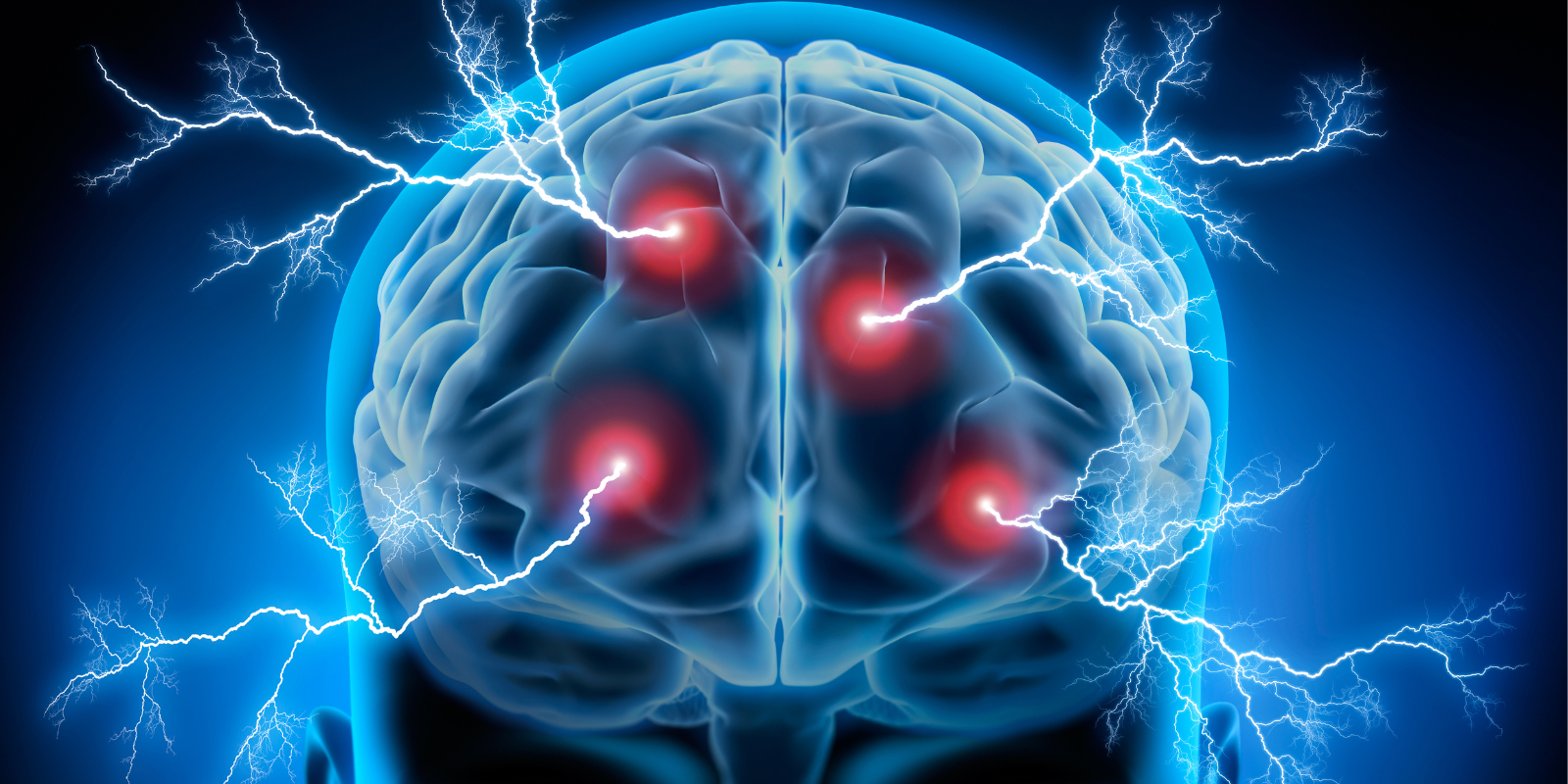 Stylized image of electric currents and neurons firing in the brain.