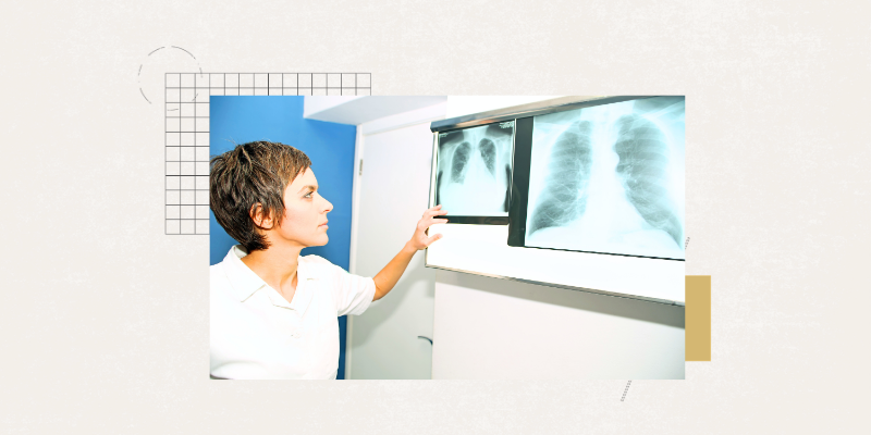 female doctor examining X-ray
