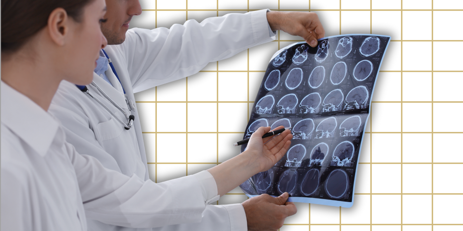 Multiple Sclerosis Is Now Easier to Diagnose — But Is That a Good Thing?