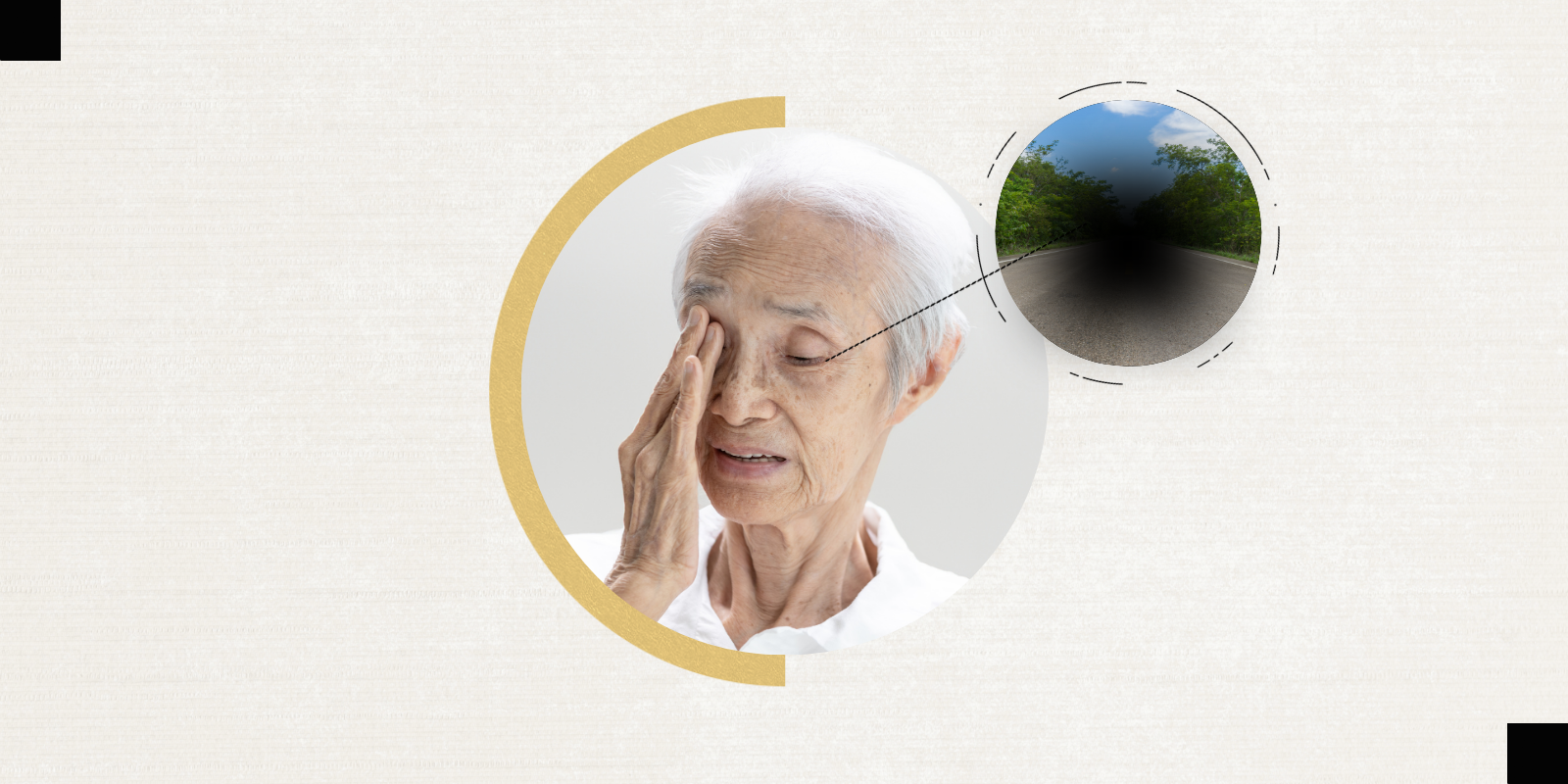 An older adult holds a hand up to one of their eyes. To the right, there is an image of a road that has a black circle blocking the center vision of the road.