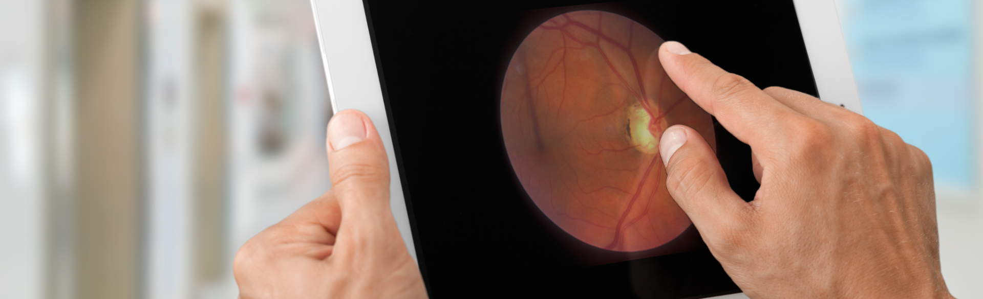 Can AI Reliably Diagnose Glaucoma?