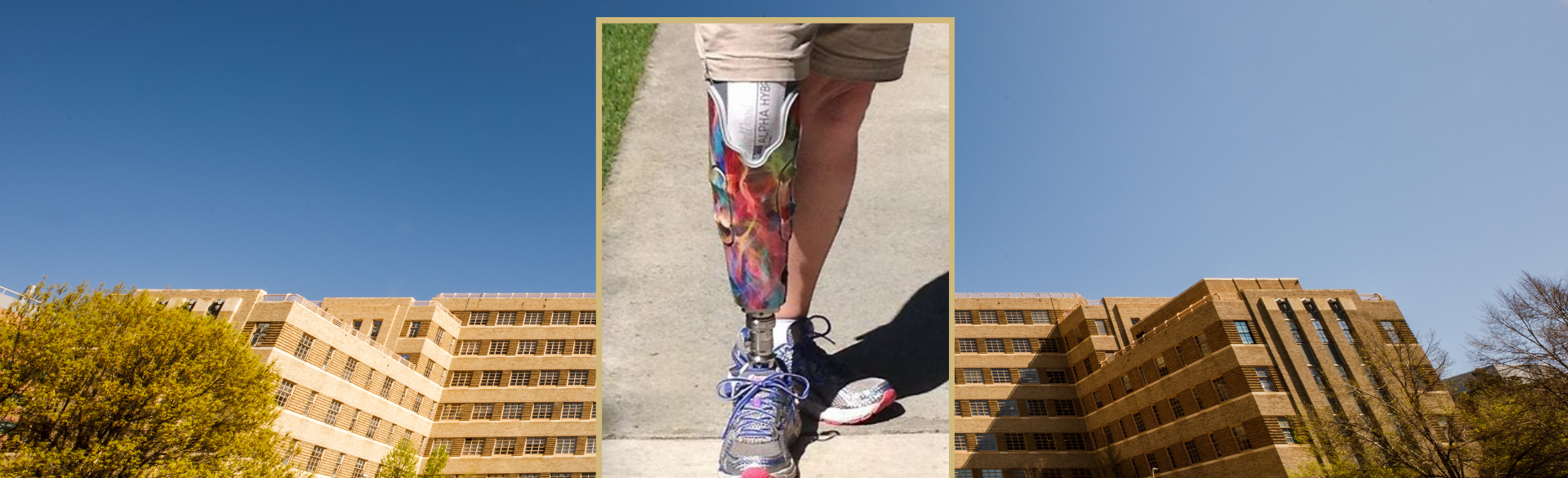 Image of a prosthetic leg. 