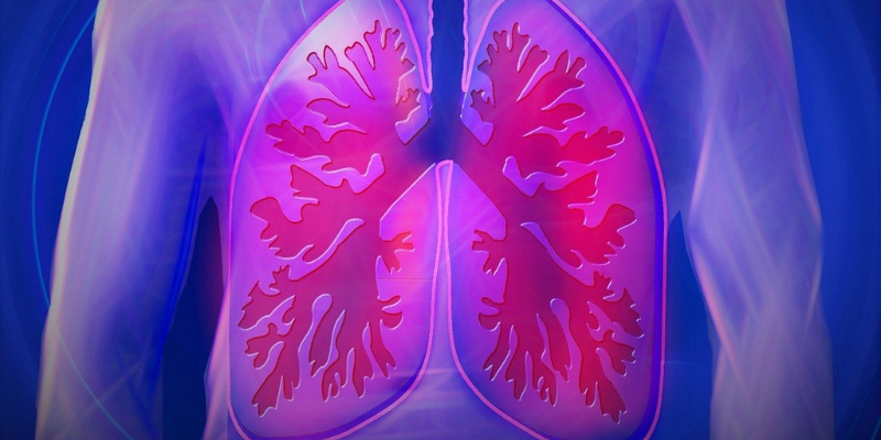 Integrating Palliative Care in Severe Chronic Obstructive Lung Disease