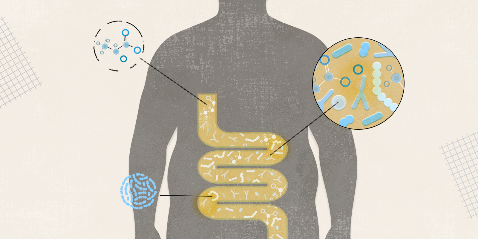 Graphic image of a colon inside a silhouette of a large body with three circles of microorganisms, all with lines pointing to the colon
