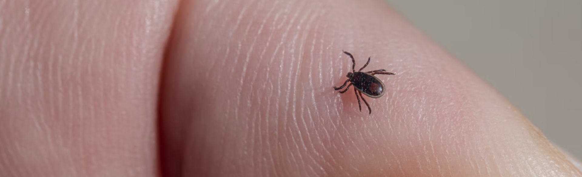 Tick on a person