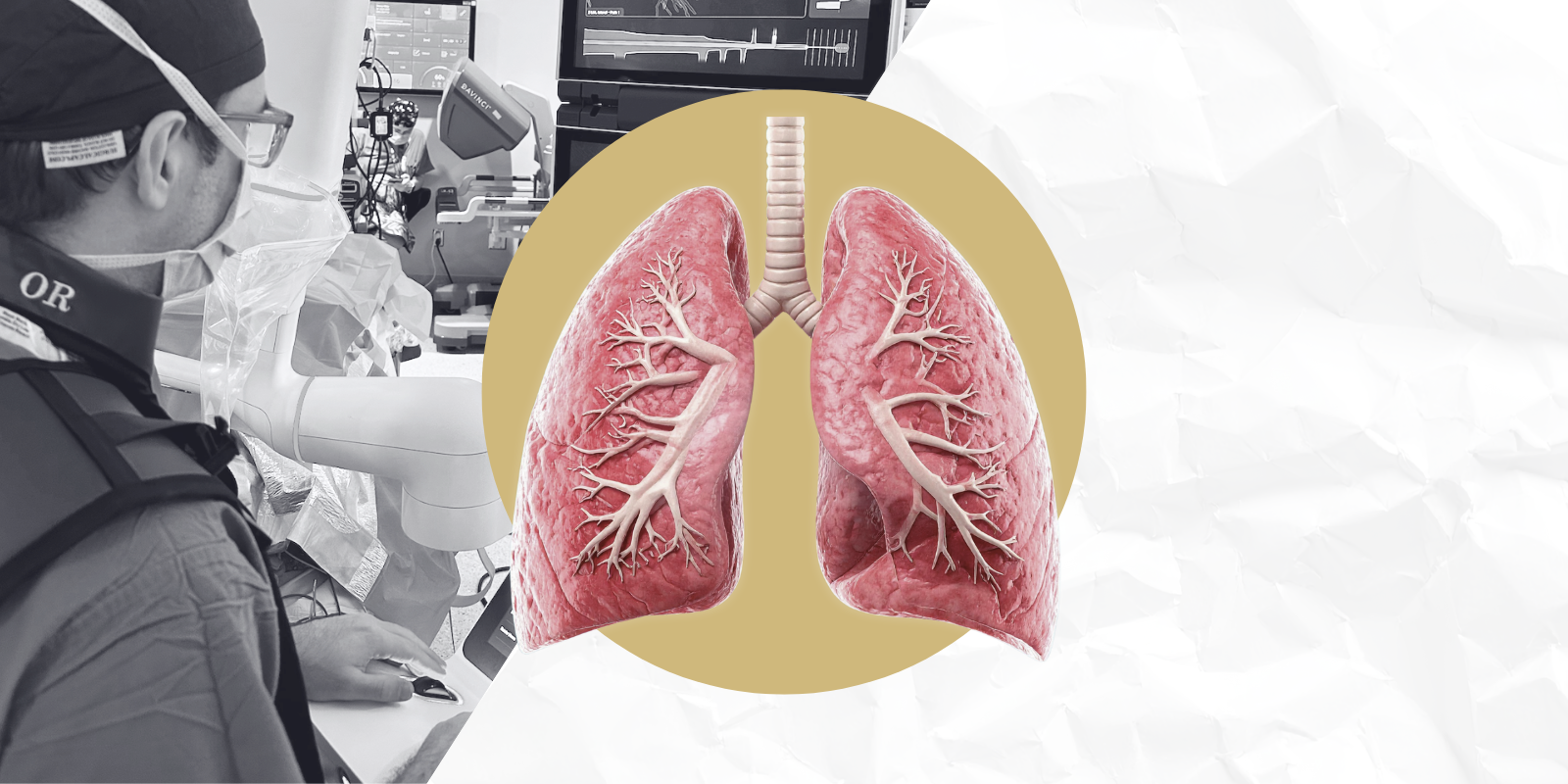 New Technologies Allow CU Lung Surgeons to See Cancer Better