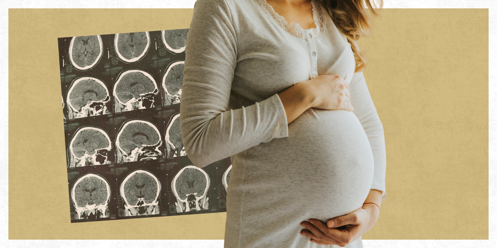 A pregnant woman cradles her round belly. A scan with multiple brain images is in the background 