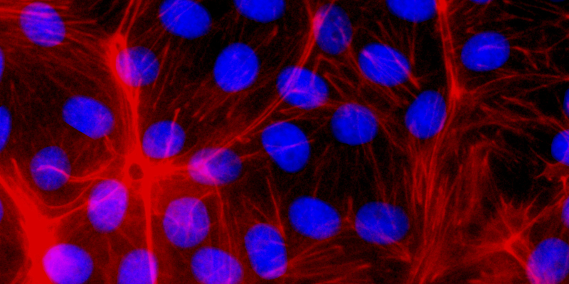 Painting Cells with Science: How High-Content Imaging is Changing the Game