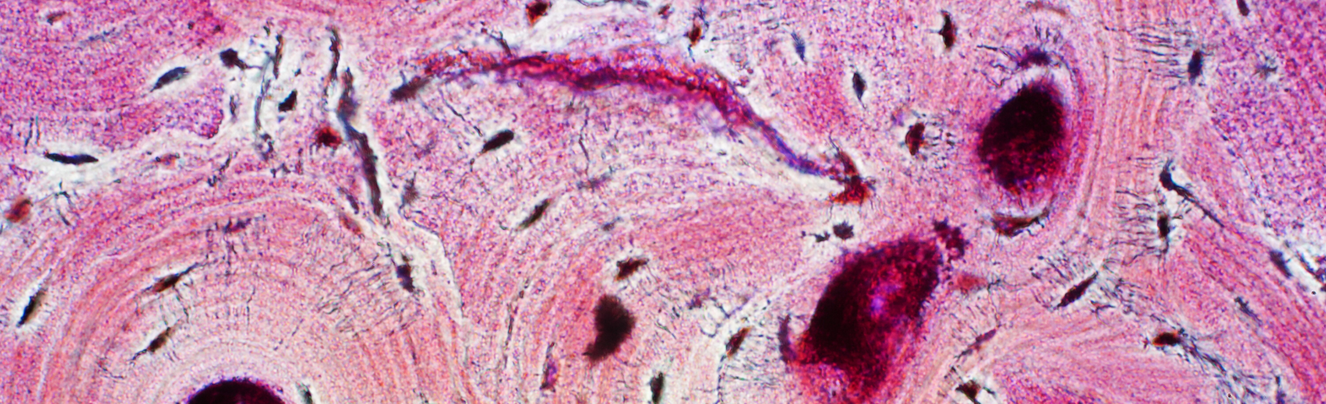 ORIEN is a network of cancer centers that shares data and tissue samples from more than 273,000 patients. 