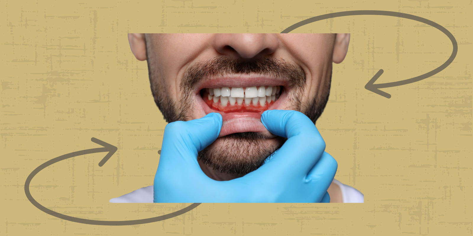 The Mouth-Body Connection: Why Treating Gum Disease Matters More Than You Think