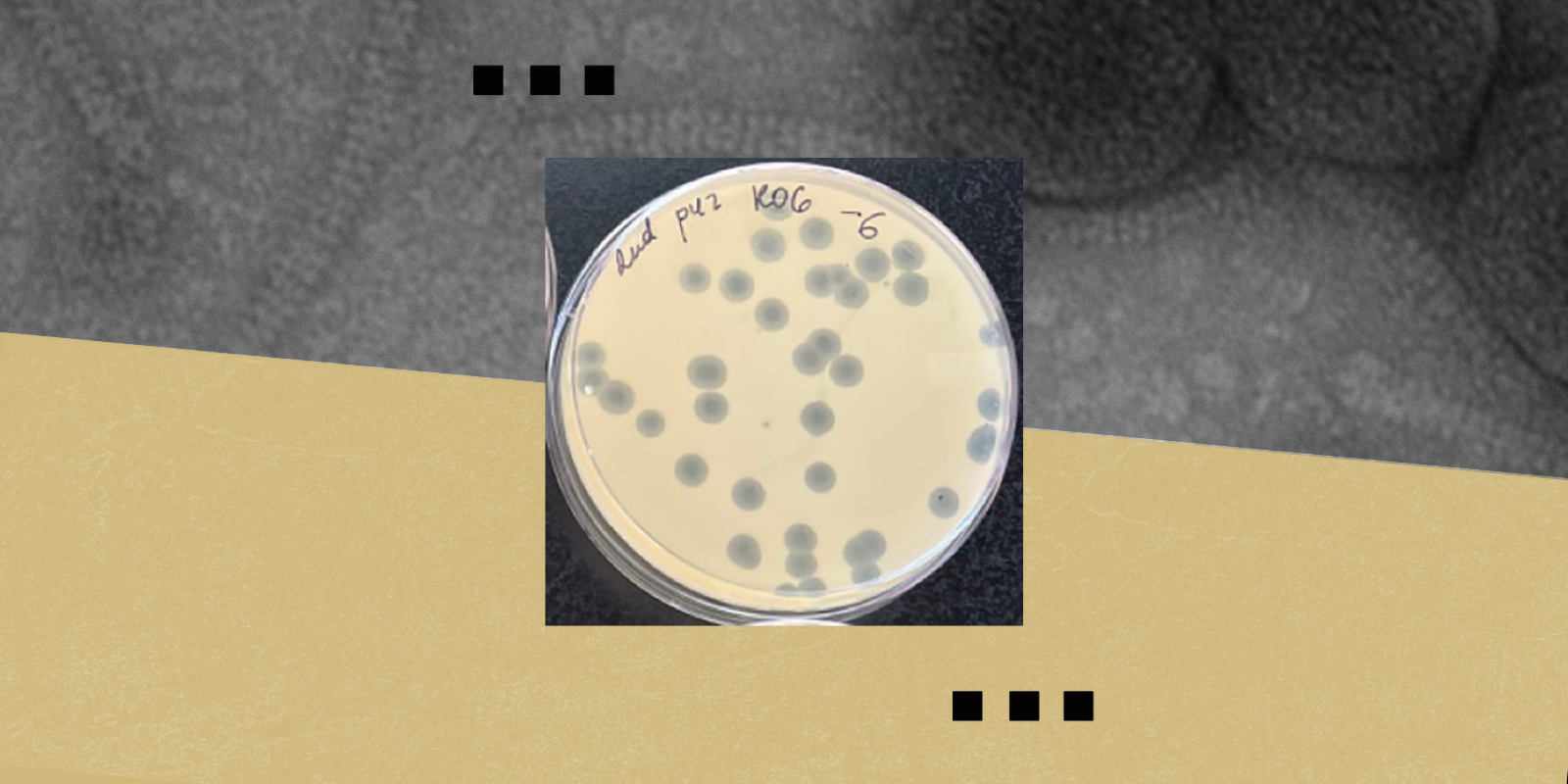 Agar plate with bacterial culture and plaques | University of Colorado Anschutz School of Medicine