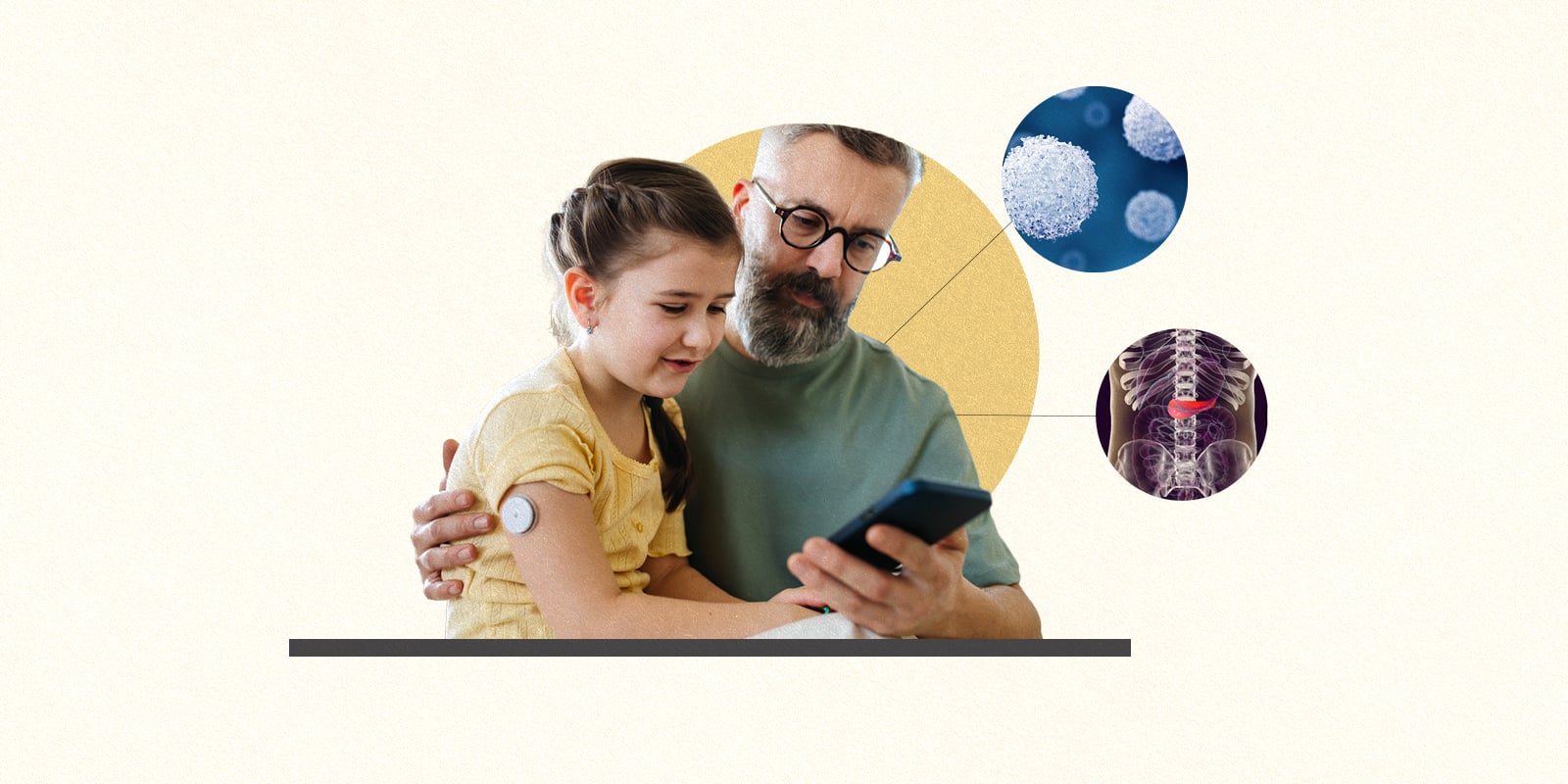 A young girl with a white, round glucose monitor sensor attached to her upper arm looks at a cellphone screen with her dad; depictions of cells and of a pancreas nearby