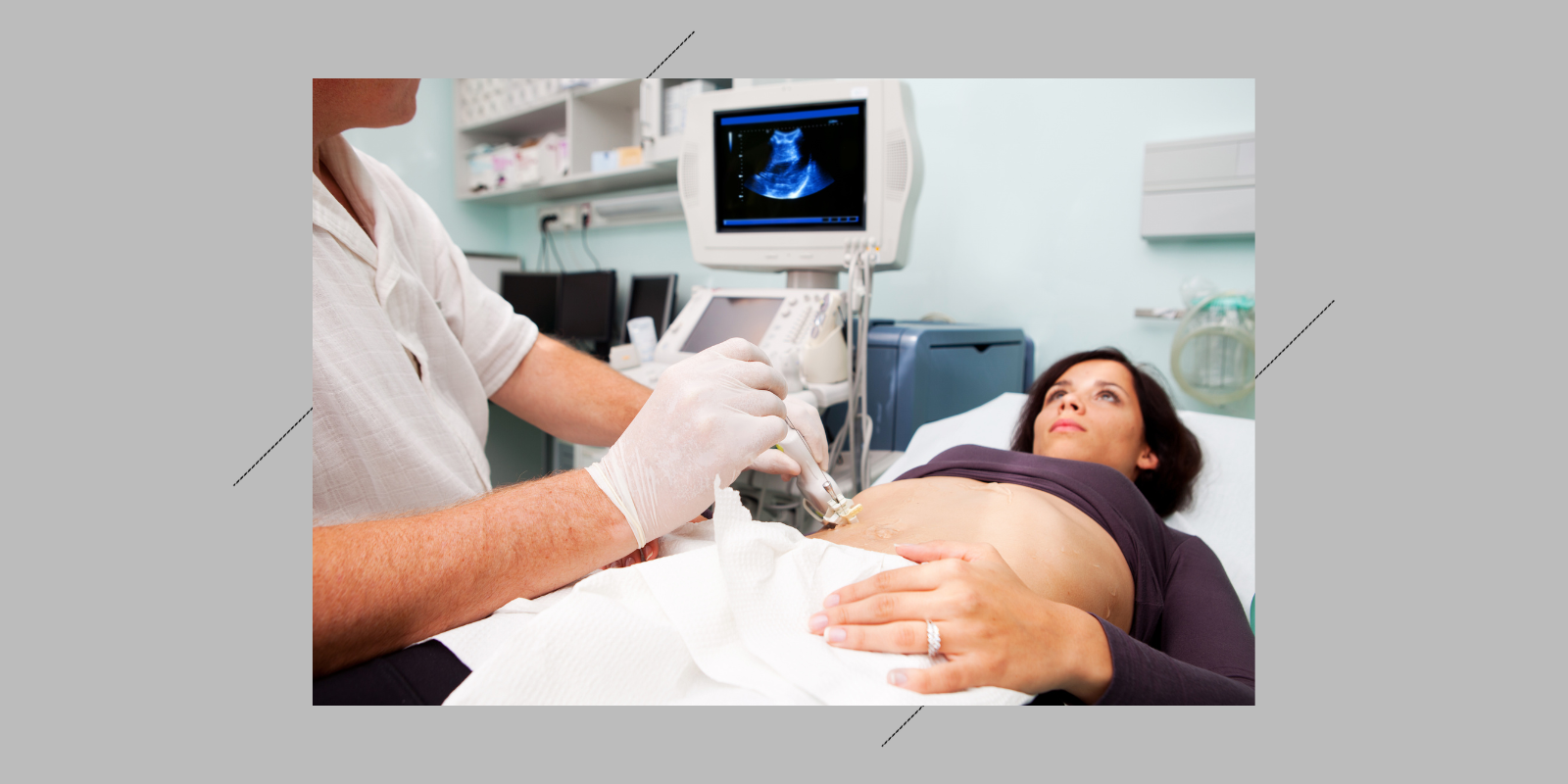 Woman receiving ultrasound while lying on table