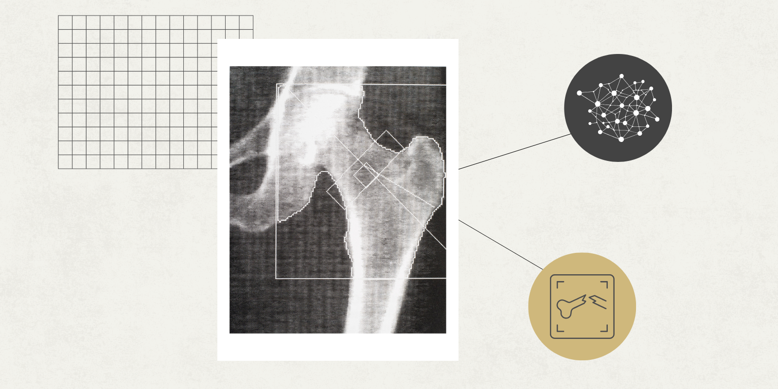 Graphic of a bone scan 