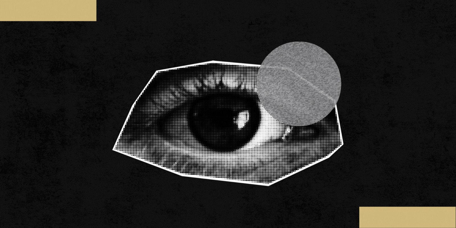 Investigating What Sets Visual Snow Syndrome Apart from Migraines