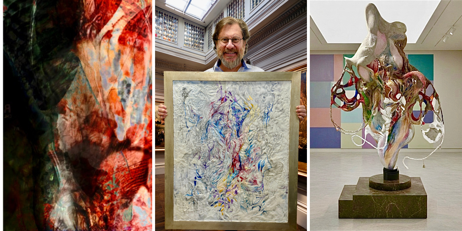 Dr. Belkind-Gerson with his art