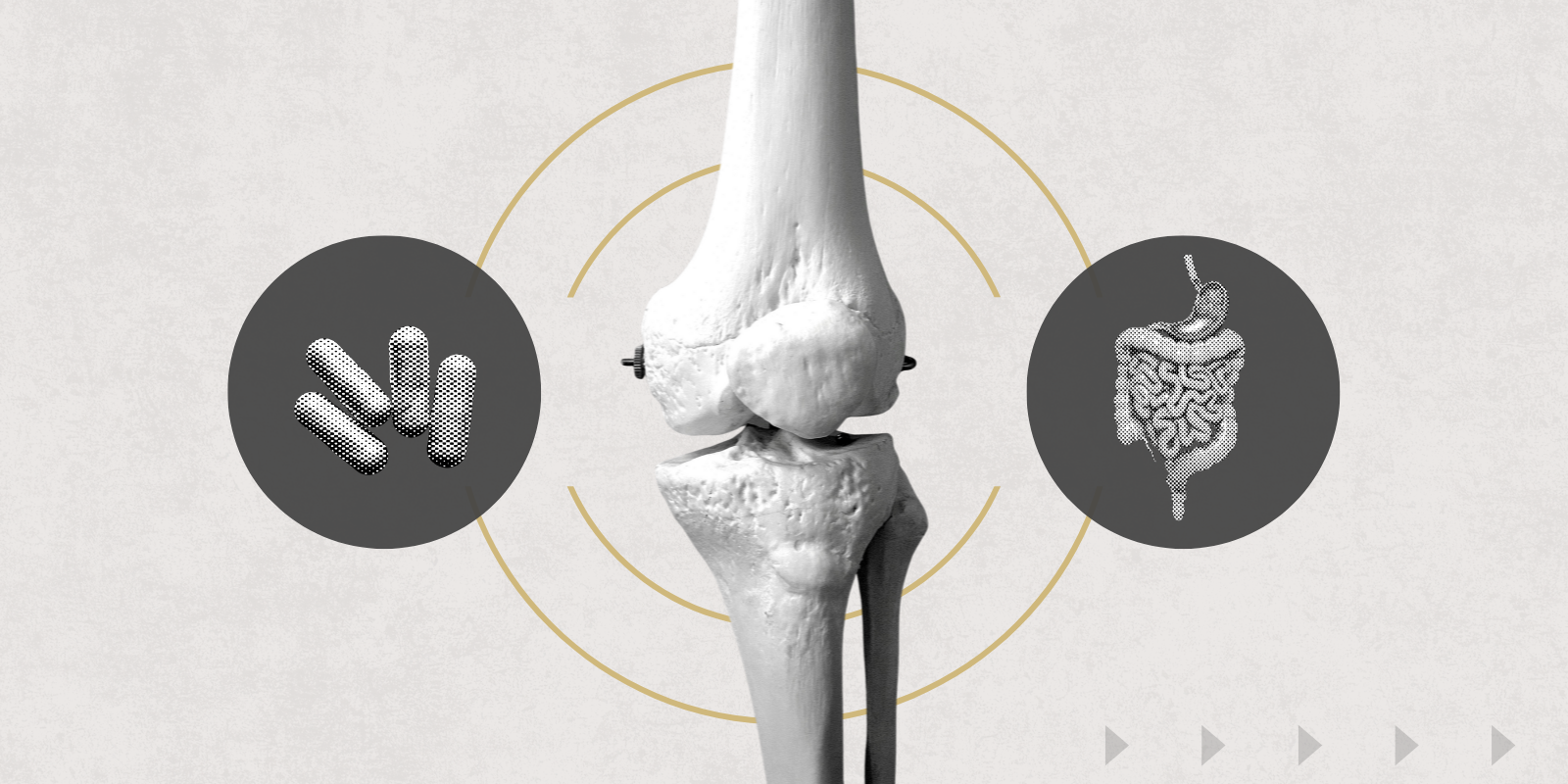 New CU Anschutz Research Explores the Connection Between the Gut and Skeletal Health