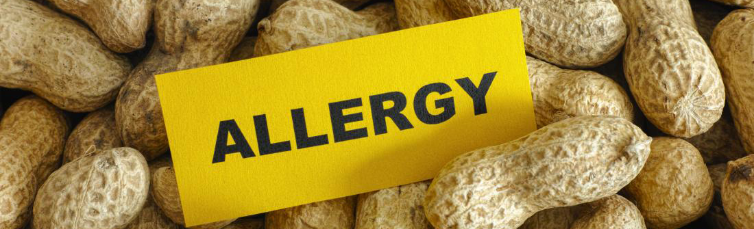 Peanuts in shells and the word allergy