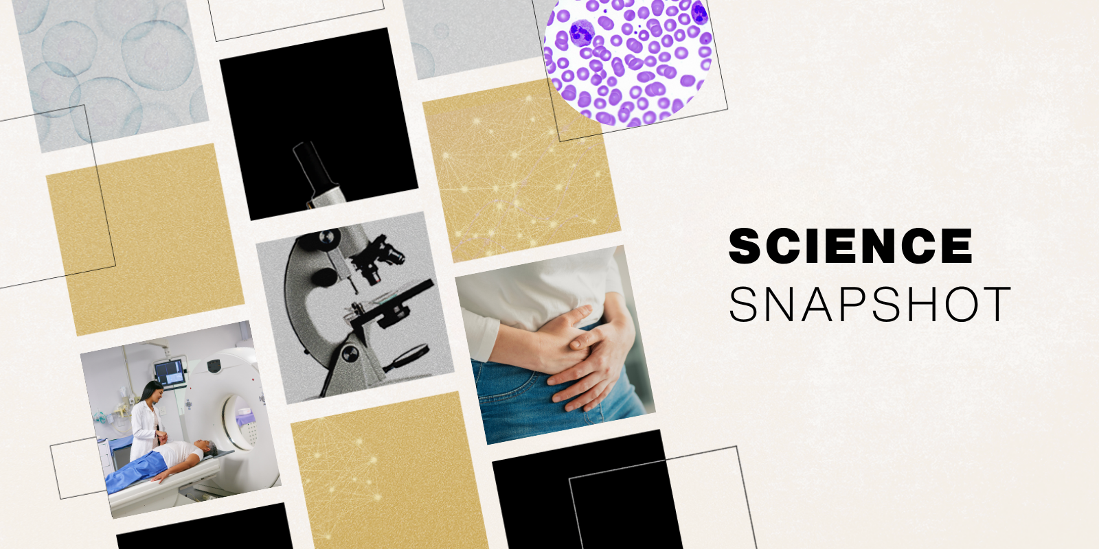 Graphic of snapshot-like reels with gold, black and gray boxes, one with a provider helping a patient into an MRI machine, one with a microscopic, one with a close up of a person holding her stomach and one of neutrophils