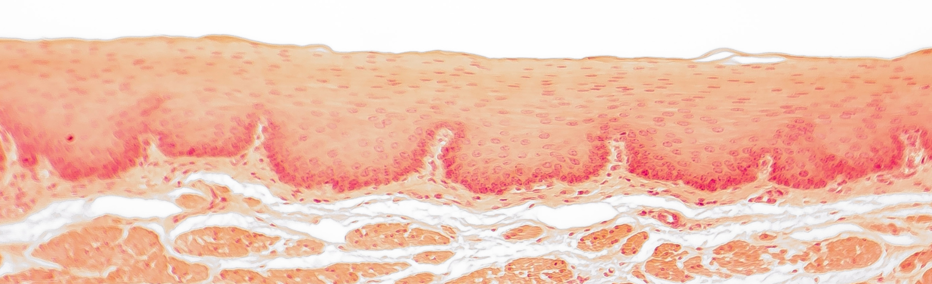 Esophageal mucosa | University of Colorado Cancer Center