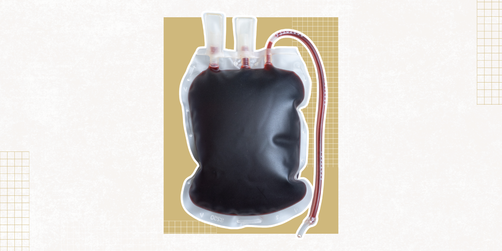 IV bag containing blood