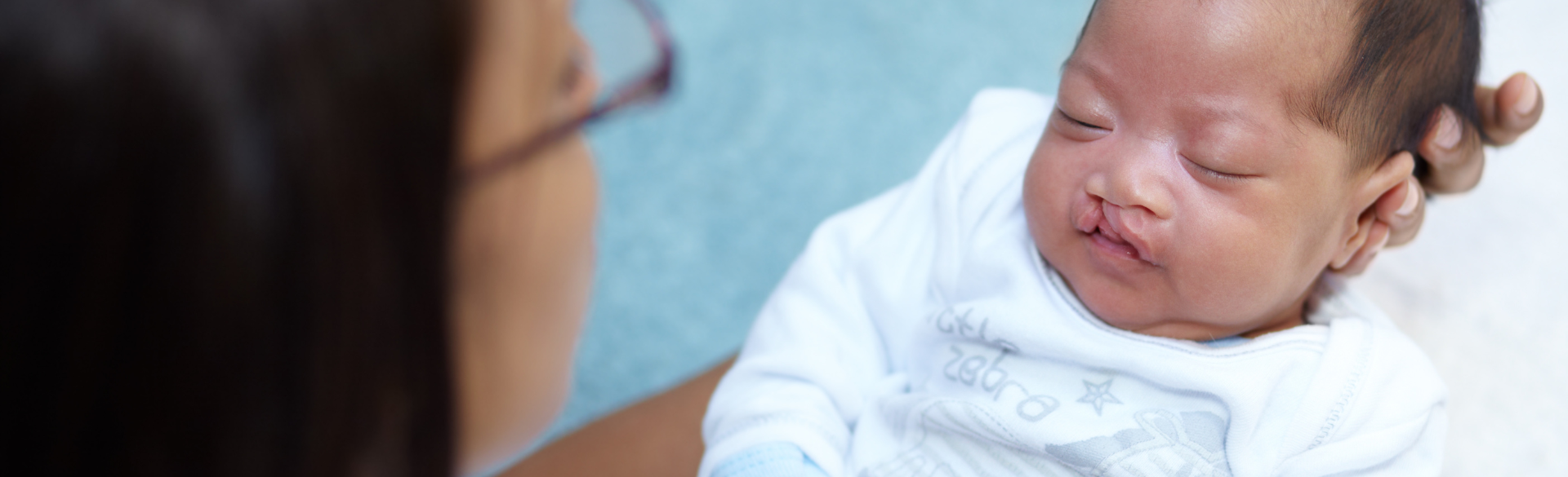 doctor holding a baby with cleft lip and palate