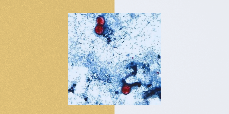 Cyclosporiasis cells