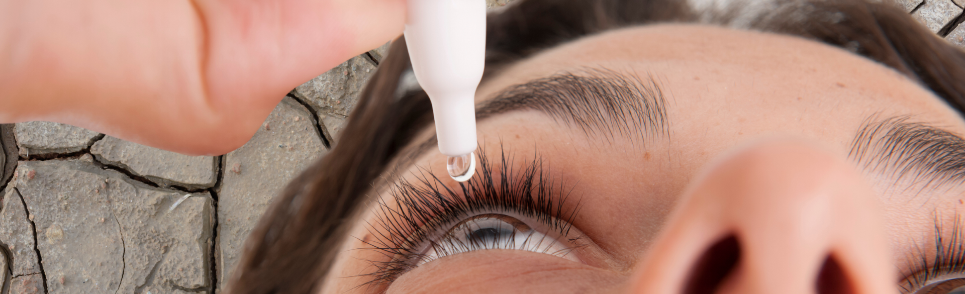 How a CU Ophthalmologist Treats her Dry Eye